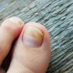 nailcare pen Profile Picture
